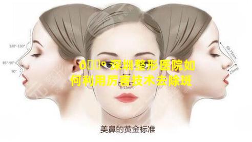 🌺 深圳整形医院如何利用厉害技术去除斑